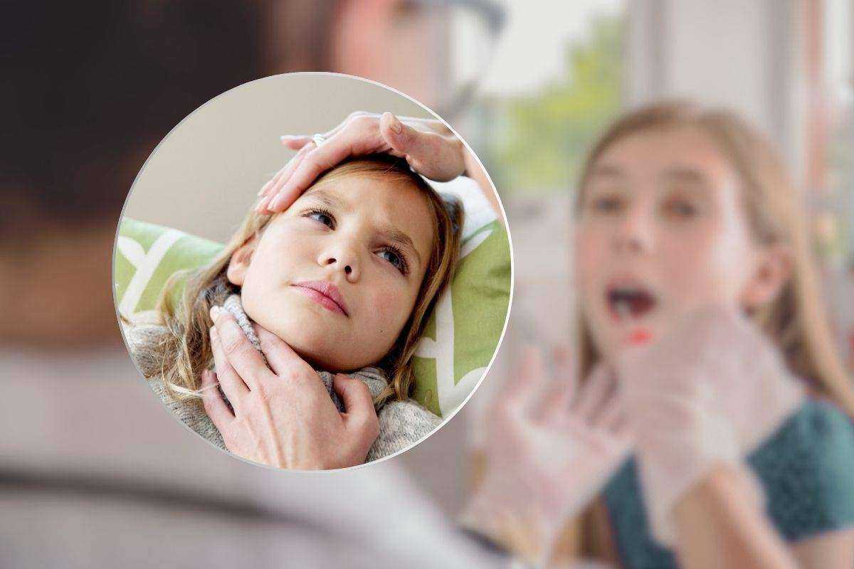 Incidenza crescente di Streptococco nei bambini