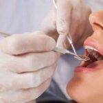 Dentista che esamina i denti di una paziente